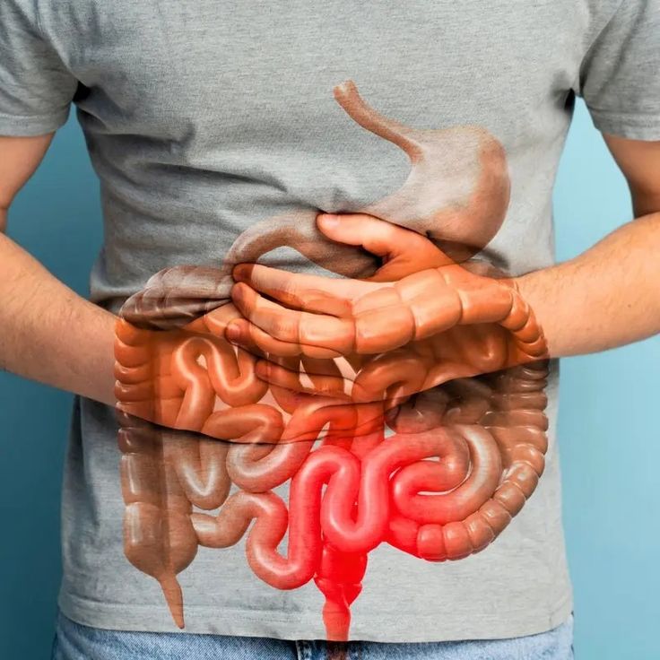 ORBIVION™  - GUT SUPPORT CAPSULE